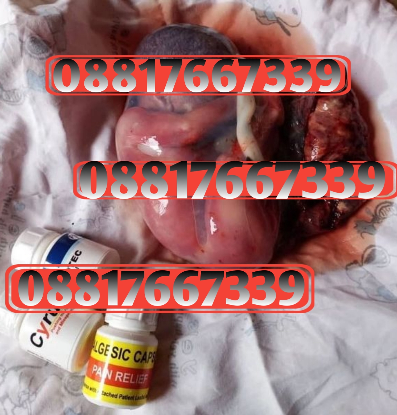 Jual Cytotec Ungaran 08817667339 Obat Aborsi Ungaran